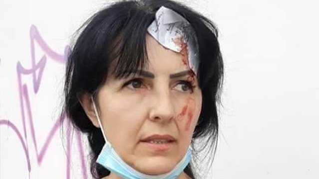 У Львові роми напали на ветерана війни Ірину Командор